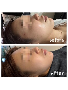 オリンピア 横浜(OLYMPIA)/