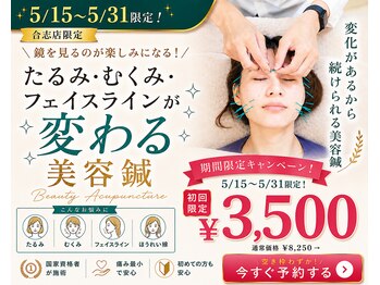 シナジープラス(SYNERGY+)の写真/【4周年記念価格】【美容鍼×小顔矯正】貴方の美を最大限に引き出すオーダーメイド施術☆たるみ改善◎