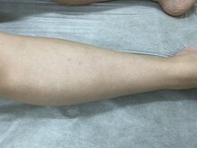 ナノハナ/鹿沼市の全身脱毛美容室ナノハナ