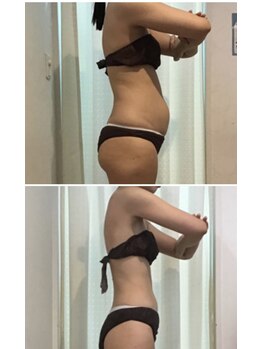 ダイヤモンドビューティー(Diamond Beauty)/劇的お腹スッキリ