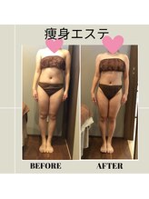 ムーン(MOON)/痩身全身コース体験