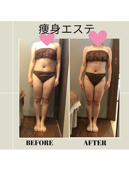 ムーン(MOON)/痩身全身コース体験