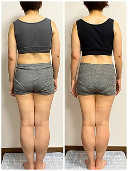 リンド(Lindo)/筋膜リリース