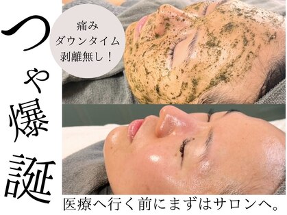 プティメゾン(Petit maison)の写真