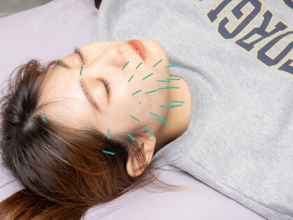 たきもと鍼灸整骨院の写真