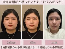 フラン(franc)