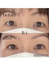 アールアイ(R-i)/アイリッドアップパーマ