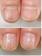WRネイルズ(WR Nails)の写真/最強のネイルケアメソッド導入！短期間で深爪、丸爪等のコンプレックスから卒業♪美しい縦長爪へ導きます◎