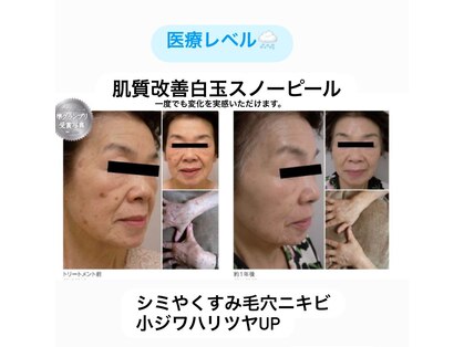 フローラの写真