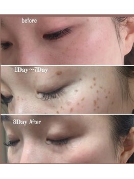 ミラージュ(mirage)/ホワイトラボ取り放題(15分)