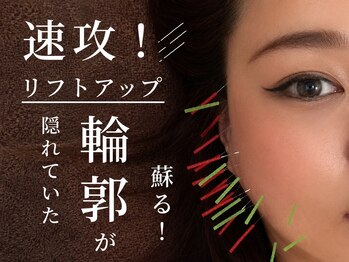 ルディア 堂島店(ledia)/美容鍼で輪郭が蘇る!|梅田