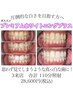 【しっかり白くしたい・持続したい】黄ばみ悩み解消◎3回来店110分照射