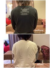 ヴィラ整骨院/巻き肩改善に◎