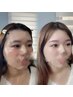  【眉毛大革命！】30分クイック眉毛ワックス脱毛×トーンアップ眉毛カラー