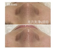 アルカンジュ(archange)の雰囲気（初めてエステにおすすめ◎クイック毛穴洗浄メニューもご用意☆）