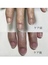 ハンドケア/ネイルケア