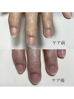ハンドケア/ネイルケア