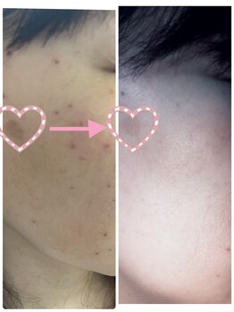 ルアンジュ(Le Ange)/