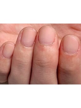 爪の悩みを解消できる（ケア含む）