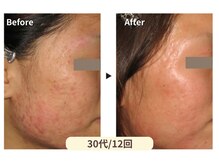 美男美女 奈良三条店/自信が持てる素肌へ