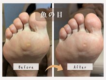 菊桃(kikumomo)の雰囲気（大きくて魚の目も、痛みのないフットケアで除去します！）