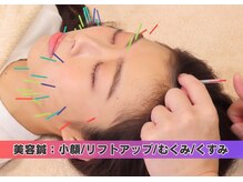 鴨居よつば整骨院/美容鍼
