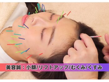 鴨居よつば整骨院/美容鍼