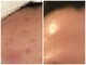 スハダボーテ(Suhada-beaute)の写真