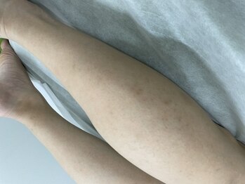 ナノハナ/鹿沼市の全身脱毛美容室ナノハナ