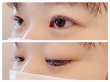 ビタミン(Vitamin*)/