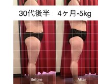 エモーション 横浜関内店(Emotion)/本格ハイパースリムムーヴプラス