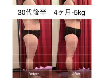 エモーション 横浜関内店(Emotion)/本格ハイパースリムムーヴプラス