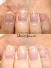 マリーロール 梅田店(Marie Laure)/自爪育成/深爪矯正/ネイルケア