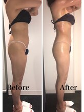 インフィニーズ(INFINEEZ)/カスタマイズ120分全身痩身