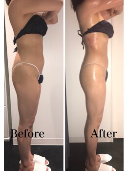 インフィニーズ(INFINEEZ)/カスタマイズ120分全身痩身