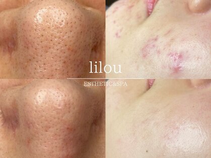 リル 和歌山市店(lilou)の写真