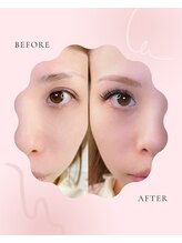 アイル 釧路昭和店(eyell)/まつげエクステ★before/after