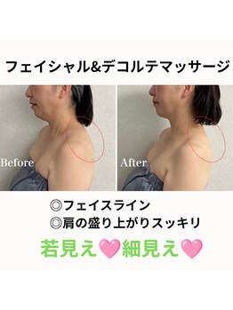 シュ シュ(chou chou)/フェイシャルデコルテマッサージ