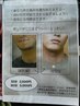 【お試しLED脱毛◎】ローズ脱毛 10分