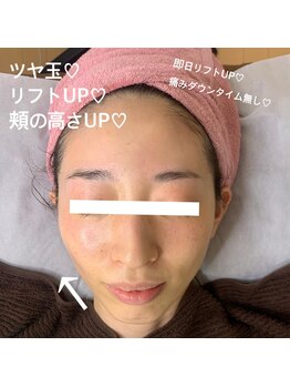 ラ フルール(La Fleur)/エ水光ジェット エアバリエステ