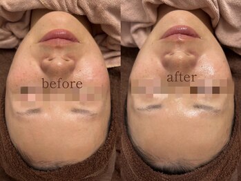 サロン エム(saron M)/お客様ビフォーアフター