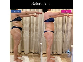 ファウンデーション(FOUNDATION)/最新機種!痩身マシーン!