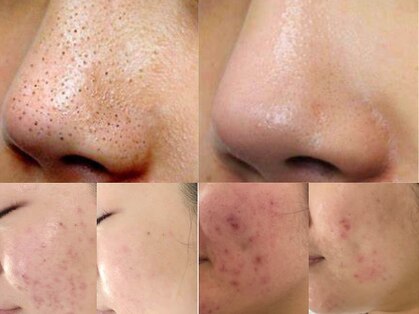 モアビューティー 庚午店(MORE BEAUTY)の写真