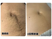 スリーアイ(THREE AI)/◆before→after◆