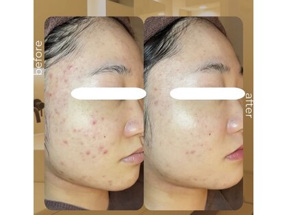 コキュウ(KOKYU)の写真