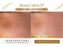 ナンバー(N°)の雰囲気（【毛穴の開き・黒ずみに】つるんと毛穴集中フェイシャル ￥11,900）
