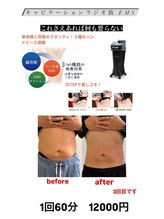 たけ子/痩身マシン