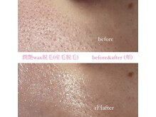 クレヴィー(Creviy)/潤艶wax脱毛(産毛脱毛)1回施術