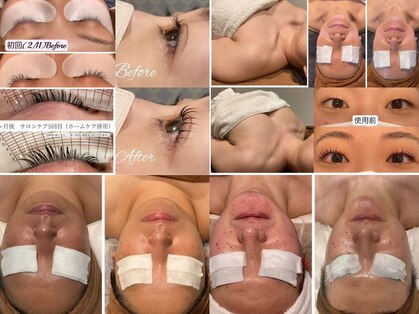 アイラブワン(eye love one)の写真