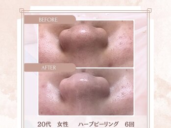 モア 多治見店(MORE)/お客様ビフォーアフター♪